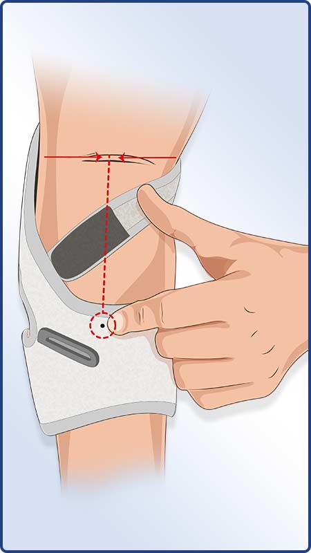 Instructies voor het aanbrengen van de Masalo manchet MED - Positie van de onderrijmanchet